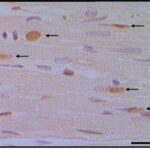 Cardiac Muscle (exposed)