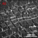Cardiac Muscle (magnified, unexposed No.2)