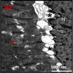 Cardiac Muscle (magnified, exposed No.2)