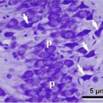 Ammon's Horn of the Hippocampus (exposed, magnified)