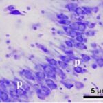 Ammon's Horn of the Hippocampus (unexposed, magnified)