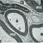 Trigeminal Nerve and Myelin Sheath (unexposed, magnified)