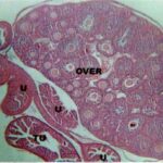 Ovary (unexposed)