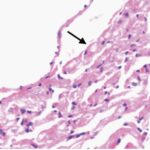 Sinus node (exposed, day 7)