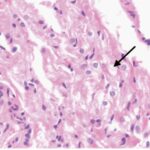 Sinus node (exposed, month 6)