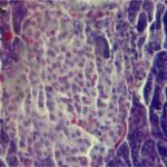 Islet of Langerhans within the pancreas (unexposed)