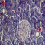 Islet of Langerhans within the pancreas (exposed)
