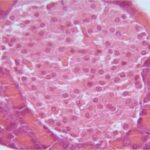 Islet of Langerhans (unexposed)