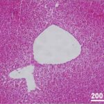 Liver (exposed)