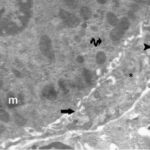 Liver (magnified, unexposed No.1)