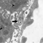 Liver (magnified, unexposed No.2)