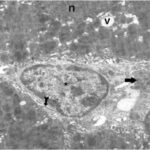 Liver (magnified, exposed No.3)
