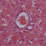 Liver