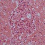 Liver (exposed for 6 h/day)