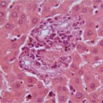 Liver (exposed for 3 h/day)