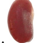 Gross Observation of the Kidney (unexposed)
