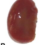 Gross Observation of the Kidney (exposed for 40 min/day)