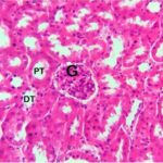 Kidney (unexposed)
