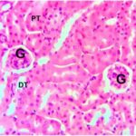 Kidney (exposed for 40 min/day)