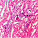 Kidney (exposed for 60 min/day No.1)