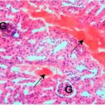 Kidney (exposed for 60 min/day No.2)