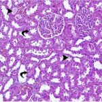 Kidney 1 (exposed for 6 h/day)