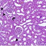 Kidney 1 (exposed for 12 h/day)
