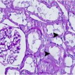 Kidney 2 (exposed for 12 h/day)