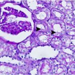 Kidney 2 (exposed for 6 h/day)