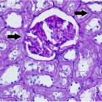 Kidney 2 (unexposed)