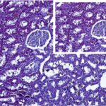Kidney 3 (unexposed)