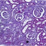 Kidney 3 (exposed for 6 h/day)