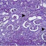 Kidney 3 (exposed for 12 h/day)