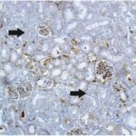 Kidney 4 (unexposed)