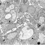 Astrocyte (exposed)