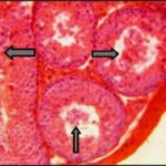 Seminiferous Tubules within the Testis (exposed No.2)