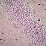 Dentate Gyrus of the Adult Hippocampus (exposed)