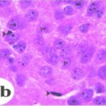 Ammon's Horn of the Adult Hippocampus (unexposed, magnified)