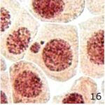 Micronucleus No.1