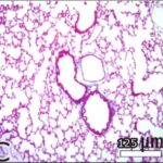 Lung (unexposed)