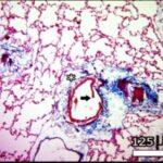 Lung (exposed)