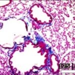 Lung (exposed, antioxidant)