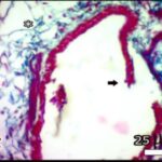 Lung (magnifed, exposed)