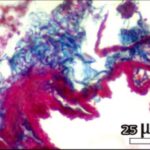 Lung (magnifed, exposed, antioxidant)