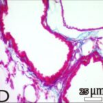 Lung (magnifed, unexposed)