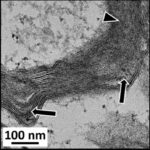 Myelin Sheath in Cerebral Cortex No.2 (exposed)