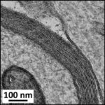 Myelin Sheath in Cerebral Cortex No.1 (unexposed)