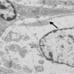 Sinus node (magnified, exposed, day 28 No.2)