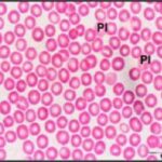 Blood Smear (unexposed)
