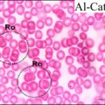 Blood Smear (exposed for 15 min/day)